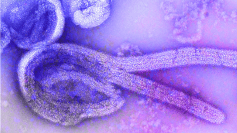 The Ebola virus at the microscopic level